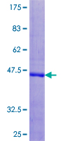 UCN3 / SPC Protein - 12.5% SDS-PAGE of human UCN3 stained with Coomassie Blue