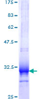 UCP1 / UCP-1 Protein - 12.5% SDS-PAGE Stained with Coomassie Blue.