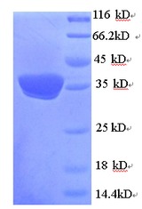 UCP1 / UCP-1 Protein
