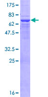 UEVLD Protein - 12.5% SDS-PAGE of human UEV3 stained with Coomassie Blue