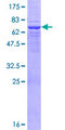 UEVLD Protein - 12.5% SDS-PAGE of human UEV3 stained with Coomassie Blue