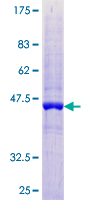 UFC1 Protein - 12.5% SDS-PAGE of human UFC1 stained with Coomassie Blue