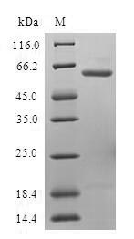UFD1L Protein - (Tris-Glycine gel) Discontinuous SDS-PAGE (reduced) with 5% enrichment gel and 15% separation gel.