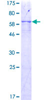 UGCG Protein - 12.5% SDS-PAGE of human UGCG stained with Coomassie Blue