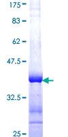 UGCG Protein - 12.5% SDS-PAGE Stained with Coomassie Blue.