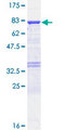 UGDH / UDPGDH Protein - 12.5% SDS-PAGE of human UGDH stained with Coomassie Blue