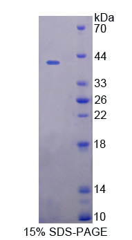 UGGT1 / UGGT Protein - Recombinant  UDP-Glucose Glycoprotein Glucosyltransferase 1 By SDS-PAGE