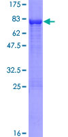 UGP2 Protein - 12.5% SDS-PAGE of human UGP2 stained with Coomassie Blue