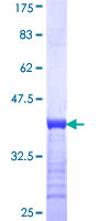UGP2 Protein - 12.5% SDS-PAGE Stained with Coomassie Blue.