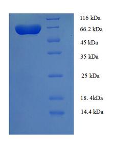 UGP2 Protein