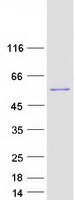 UGP2 Protein - Purified recombinant protein UGP2 was analyzed by SDS-PAGE gel and Coomassie Blue Staining