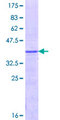 UGT1A / UGT1A1 Protein - 12.5% SDS-PAGE Stained with Coomassie Blue.