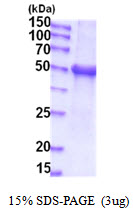 UGT1A / UGT1A1 Protein