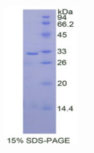 UGT1A / UGT1A1 Protein - Recombinant UDP Glucuronosyltransferase 1 Family, Polypeptide A1 (UGT1A1) by SDS-PAGE