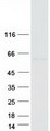 UGT1A / UGT1A1 Protein - Purified recombinant protein UGT1A1 was analyzed by SDS-PAGE gel and Coomassie Blue Staining