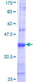 UGT1A10 Protein - 12.5% SDS-PAGE Stained with Coomassie Blue.