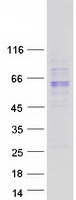 UGT1A10 Protein - Purified recombinant protein UGT1A10 was analyzed by SDS-PAGE gel and Coomassie Blue Staining