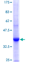 UGT1A3 Protein - 12.5% SDS-PAGE Stained with Coomassie Blue.