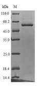 UGT1A4 Protein - (Tris-Glycine gel) Discontinuous SDS-PAGE (reduced) with 5% enrichment gel and 15% separation gel.