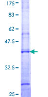 UGT1A4 Protein - 12.5% SDS-PAGE Stained with Coomassie Blue.