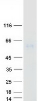 UGT1A4 Protein - Purified recombinant protein UGT1A4 was analyzed by SDS-PAGE gel and Coomassie Blue Staining