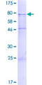 UGT1A6 Protein - 12.5% SDS-PAGE of human UGT1A6 stained with Coomassie Blue