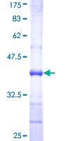UGT1A6 Protein - 12.5% SDS-PAGE Stained with Coomassie Blue.