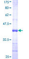 UGT1A6 Protein - 12.5% SDS-PAGE Stained with Coomassie Blue.
