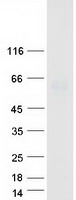 UGT1A6 Protein - Purified recombinant protein UGT1A6 was analyzed by SDS-PAGE gel and Coomassie Blue Staining