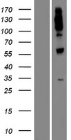 UGT1A8 Protein - Western validation with an anti-DDK antibody * L: Control HEK293 lysate R: Over-expression lysate