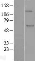 UGT1A9 Protein - Western validation with an anti-DDK antibody * L: Control HEK293 lysate R: Over-expression lysate