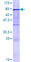 UGT1A9 Protein - 12.5% SDS-PAGE of human UGT1A9 stained with Coomassie Blue