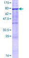 UGT1A9 Protein - 12.5% SDS-PAGE of human UGT1A9 stained with Coomassie Blue