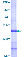 UGT1A9 Protein - 12.5% SDS-PAGE Stained with Coomassie Blue.