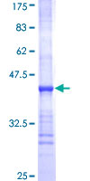 UGT2B10 Protein - 12.5% SDS-PAGE Stained with Coomassie Blue.