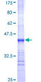 UGT2B10 Protein - 12.5% SDS-PAGE Stained with Coomassie Blue.