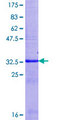 UGT2B15 Protein - 12.5% SDS-PAGE Stained with Coomassie Blue.