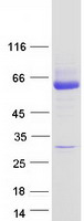 UGT2B15 Protein - Purified recombinant protein UGT2B15 was analyzed by SDS-PAGE gel and Coomassie Blue Staining