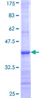 UGT2B7 Protein - 12.5% SDS-PAGE Stained with Coomassie Blue.