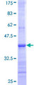 UGT2B7 Protein - 12.5% SDS-PAGE Stained with Coomassie Blue.