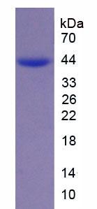 UGT2B7 Protein - Recombinant UDP Glucuronosyltransferase 2 Family, Polypeptide B7 (UGT2B7) by SDS-PAGE