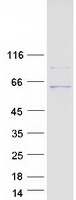 UGT3A1 Protein - Purified recombinant protein UGT3A1 was analyzed by SDS-PAGE gel and Coomassie Blue Staining