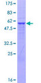UHMK1 / KIS Protein - 12.5% SDS-PAGE of human UHMK1 stained with Coomassie Blue