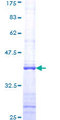 UHMK1 / KIS Protein - 12.5% SDS-PAGE Stained with Coomassie Blue.