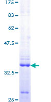 UHRF1 Protein - 12.5% SDS-PAGE Stained with Coomassie Blue.