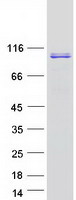 UHRF1 Protein - Purified recombinant protein UHRF1 was analyzed by SDS-PAGE gel and Coomassie Blue Staining