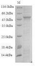 UL49 Protein - (Tris-Glycine gel) Discontinuous SDS-PAGE (reduced) with 5% enrichment gel and 15% separation gel.