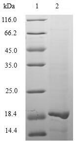 UL49 Protein - (Tris-Glycine gel) Discontinuous SDS-PAGE (reduced) with 5% enrichment gel and 15% separation gel.
