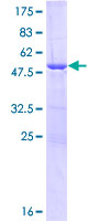 ULBP1 Protein - 12.5% SDS-PAGE of human ULBP1 stained with Coomassie Blue