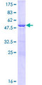 ULBP1 Protein - 12.5% SDS-PAGE of human ULBP1 stained with Coomassie Blue